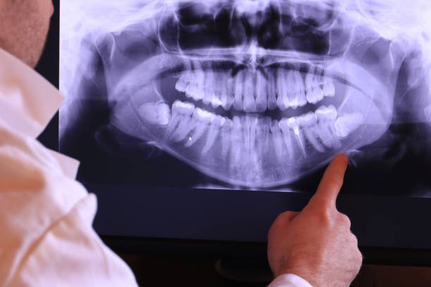 Best Emergency Treatment for Dental Infections or Abscesses in La Paloma, TX