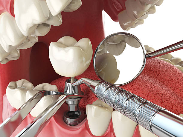 Best Weekend Emergency Dentist in La Paloma, TX